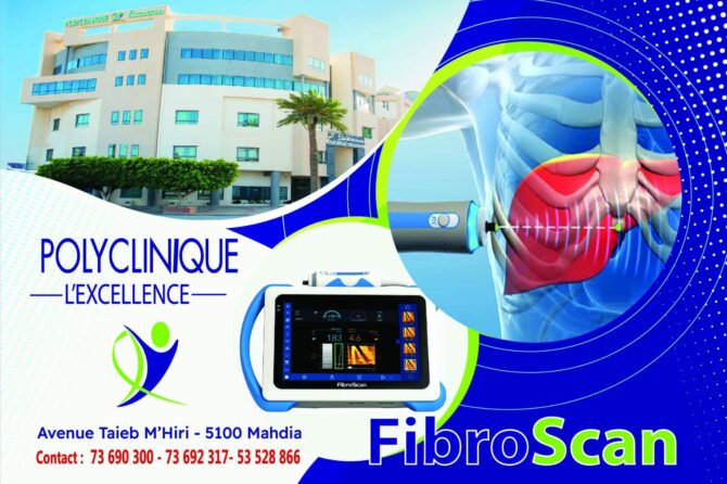 Fibro Scan